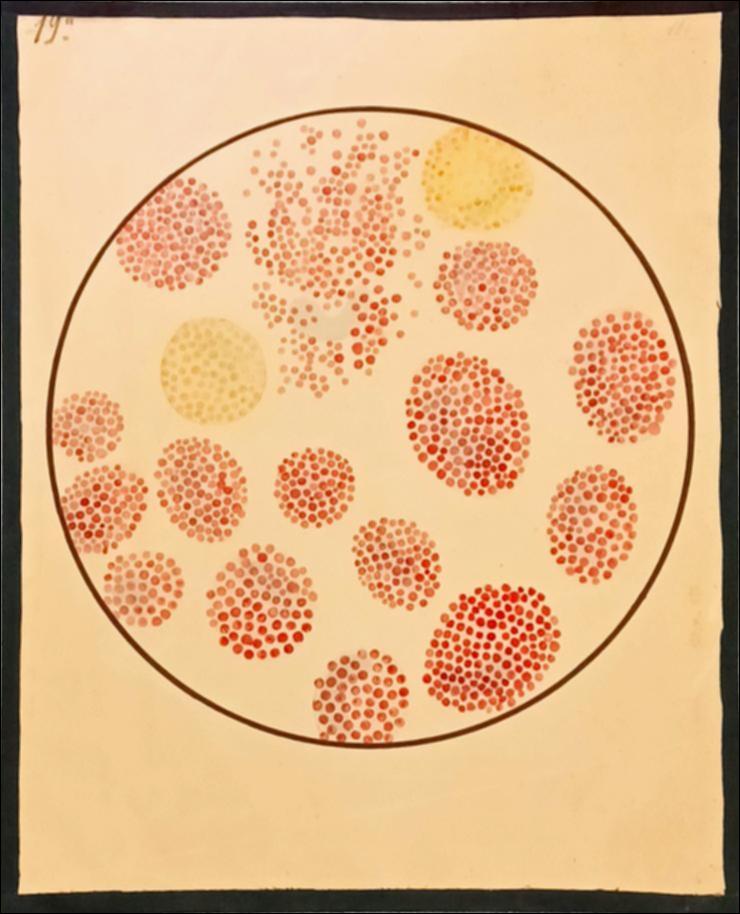 [Granulociti (striscio di sangue)]